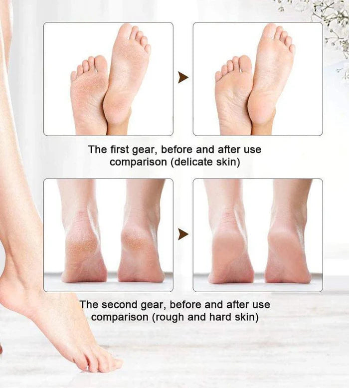 Flawless Pedi Foot Pedicure & Callus Remover